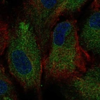 Immunofluorescent staining of human cell line BJ shows localization to endoplasmic reticulum.