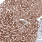 Immunohistochemical staining of human liver shows strong cytoplasmic positivity in hepatocytes.