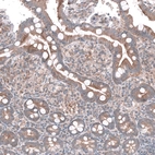 Immunohistochemical staining of human small intestine shows moderate cytoplasmic positivity in glandular cells.