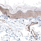 Immunohistochemical staining of human skin shows moderate cytoplasmic positivity in squamous epithelial cells.