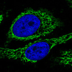 Anti-CS Antibody