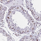 Immunohistochemical staining of human testis shows strong positivity in the nuclear membrane in a subset of cells in seminiferous ducts.