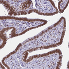 Immunohistochemical staining of human fallopian tube shows strong positivity in the nuclear membrane in glandular cells.