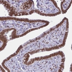 Immunohistochemical staining of human fallopian tube shows strong positivity in the nuclear membrane in glandular cells.