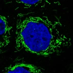 Immunofluorescence staining in A431 cell line with Anti-CS monoclonal antibody, showing specific mitochondrial staining in green. Microtubule- and nuclear probes are visualized in red and blue respectively (where available).
