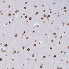 Immunohistochemical staining of human cerebral cortex shows strong positivity in the nuclear membrane in neuronal cells.