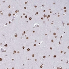 Immunohistochemical staining of human cerebral cortex shows strong positivity in the nuclear membrane in neuronal cells.