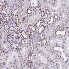 Immunohistochemical staining of human kidney shows moderate positivity in the nuclear membrane in cells in tubules.
