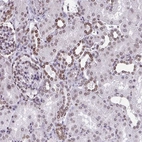 Immunohistochemical staining of human kidney shows moderate positivity in the nuclear membrane in cells in tubules.