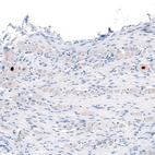 Immunohistochemical staining of mouse dorsal root ganglion shows strong nuclear immunoreactivity in single neurons.