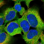 Immunofluorescent staining of human cell line HEK 293 shows positivity in cytoplasm.