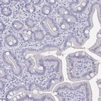 Immunohistochemical staining of human duodenum shows no positivity in glandular cells as expected.