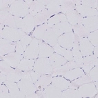 Immunohistochemical staining of human skeletal muscle shows no positivity in myocytes as expected.