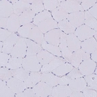 Immunohistochemical staining of human skeletal muscle shows no positivity in myocytes as expected.