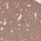 Immunohistochemical staining of human cerebral cortex shows moderate cytoplasmic positivity in neurons.