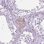 Immunohistochemical staining of human testis shows moderate cytoplasmic positivity in Leydig cells.