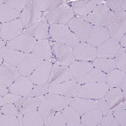 Immunohistochemical staining of human skeletal muscle shows no positivity in myocytes as expected.