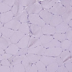 Immunohistochemical staining of human skeletal muscle shows no positivity in myocytes as expected.