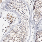 Immunohistochemical staining of human testis shows moderate cytoplasmic positivity in cells in seminiferous ducts and Leydig cells.