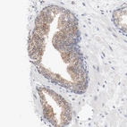 Immunohistochemical staining of human prostate shows moderate membranous/ cytoplasmic positivity in glandular cells.