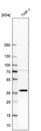 Anti-CXorf21 Antibody