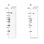 Anti-PBRM1 Antibody