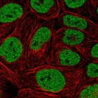 Immunofluorescent staining of human cell line RT4 shows localization to nucleoplasm.