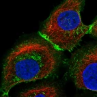 Immunofluorescent staining of human cell line HaCaT shows localization to plasma membrane, cell junctions & vesicles.