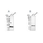 Western blot analysis using Anti-SRI antibody HPA073666 (A) shows similar pattern to independent antibody HPA019004 (B).