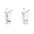 Western blot analysis using Anti-SRI antibody HPA073666 (A) shows similar pattern to independent antibody HPA019004 (B).