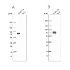 Western blot analysis using Anti-MAP2 antibody HPA012828 (A) shows similar pattern to independent antibody HPA008273 (B).