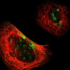 Immunofluorescent staining of human cell line A-431 shows localization to nucleoli & cytosol.