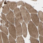 Immunohistochemical staining of human Skeletal muscle shows strong cytoplasmic positivity in myocytes.