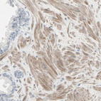 Immunohistochemical staining of human Prostate shows moderate cytoplasmic positivity in smooth muscle cells.