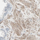 Immunohistochemical staining of human Prostate shows moderate cytoplasmic positivity in smooth muscle cells.