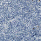 Immunohistochemical staining of human Tonsil shows very weak cytoplasmic positivity in non-germinal center cells.
