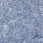 Immunohistochemical staining of human Tonsil shows very weak cytoplasmic positivity in non-germinal center cells.