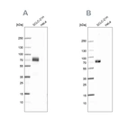 Western blot analysis using Anti-MAP2 antibody HPA008273 (A) shows similar pattern to independent antibody HPA012828 (B).