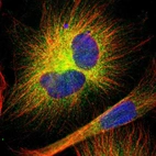 Immunofluorescent staining of human cell line U-251 MG shows localization to cytosol.