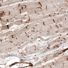 Immunohistochemical staining of human heart muscle shows moderate to strong cytoplasmic positivity in intercalated discs.