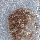 Immunohistochemical staining of human tonsil shows moderate to strong cytoplasmic positivity in germinal center cells.