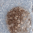 Immunohistochemical staining of human tonsil shows moderate to strong cytoplasmic positivity in germinal center cells.