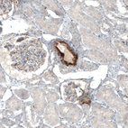 Immunohistochemical staining of human kidney shows moderate to strong cytoplasmic positivity in aortic media.