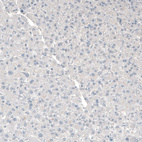 Immunohistochemical staining of human liver shows no positivity in hepatocytes as expected.