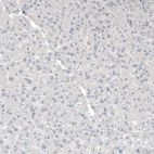 Immunohistochemical staining of human liver shows no positivity in hepatocytes as expected.