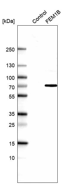 Anti-FEM1B Antibody