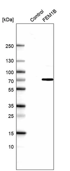 Anti-FEM1B Antibody
