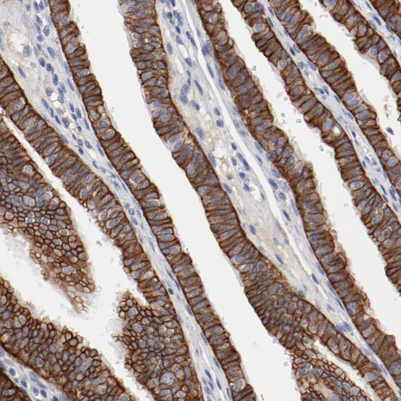 Anti-TSPAN6 Antibody