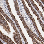 Anti-TSPAN6 Antibody