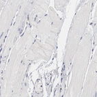 Immunohistochemical staining of human skeletal muscle shows negative membranous positivity in myocytes as expected.